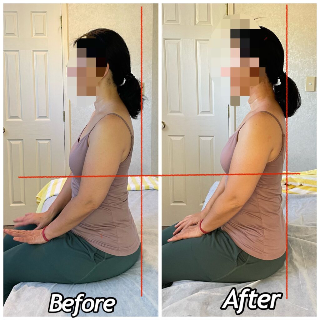 Posture before and after a Kesae session